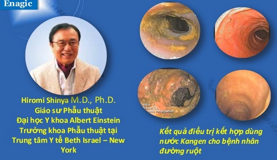 Báo giá máy lọc nước điện giải ion kiềm Kangen SD501 giá chính hãng